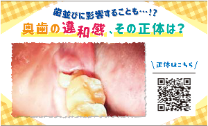 奥歯の違和感、その正体は？