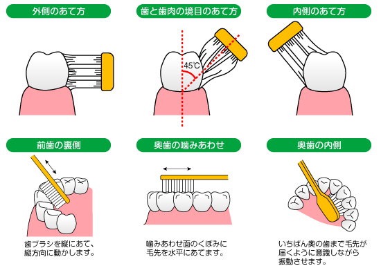 歯ブラシのあて方のイラスト説明図