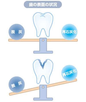 歯の表面の状況の説明図