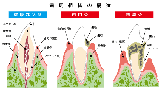 歯周組織の構造の説明図